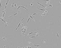 Vestibular Schwannoma Cells Treated with Mifepristone