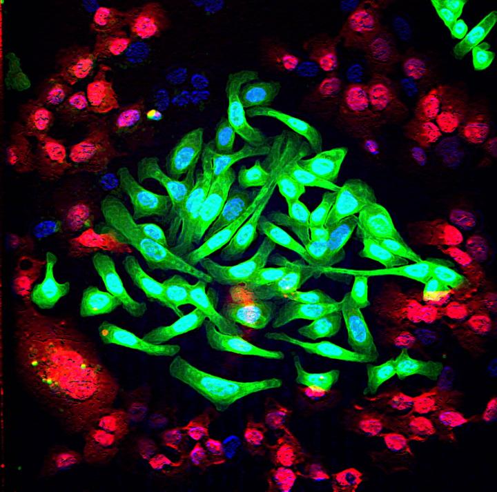 Lung Cancer Cells