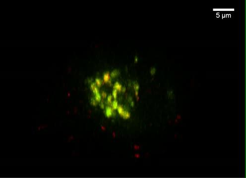 Drug-Resistant Leukemia Cell Absorbing DNA 'Trojan Horse'
