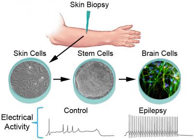 Making Neurons from Skin Cells