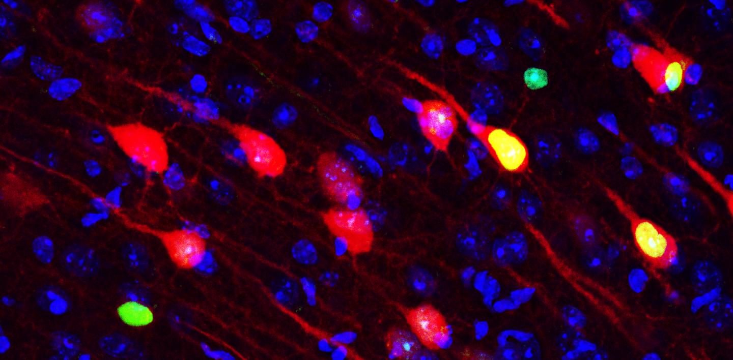 Region-specific Roles of Long-term Memory Formation (1 of 2)