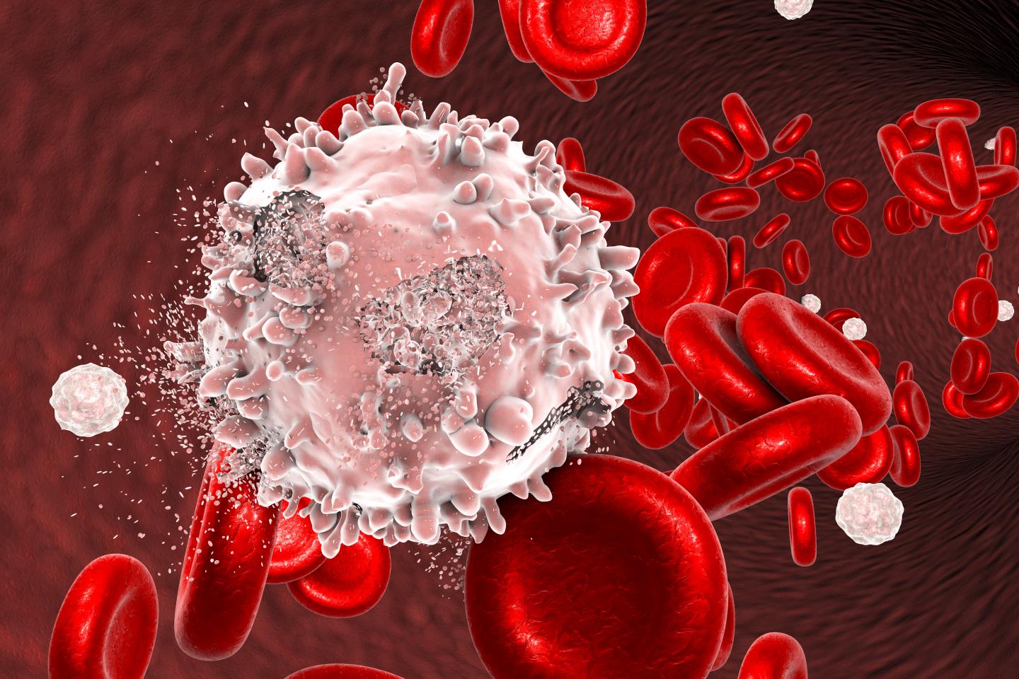 Conceptualization of Leukemia