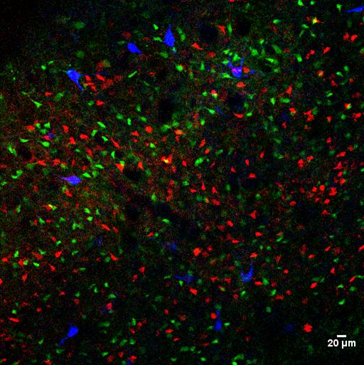 Striatum