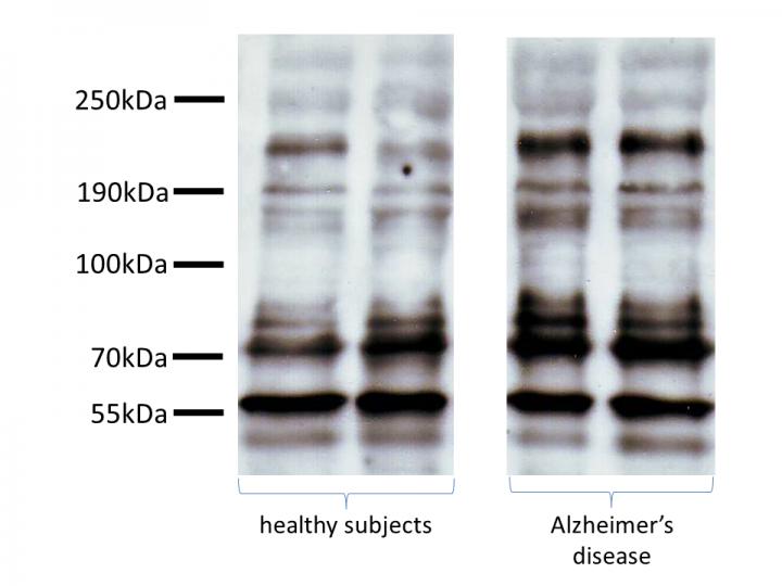 Representative Immunoblots of Platelet Tau with Tau-5 Antibody