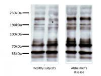 Representative Immunoblots of Platelet Tau with Tau-5 Antibody