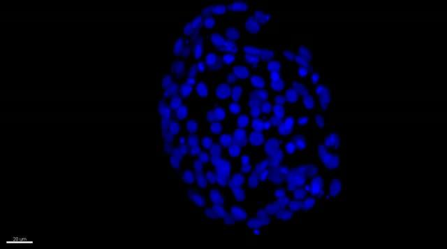 Human Pre-Implantation Embryo; Naive Embryonic Cells in Green