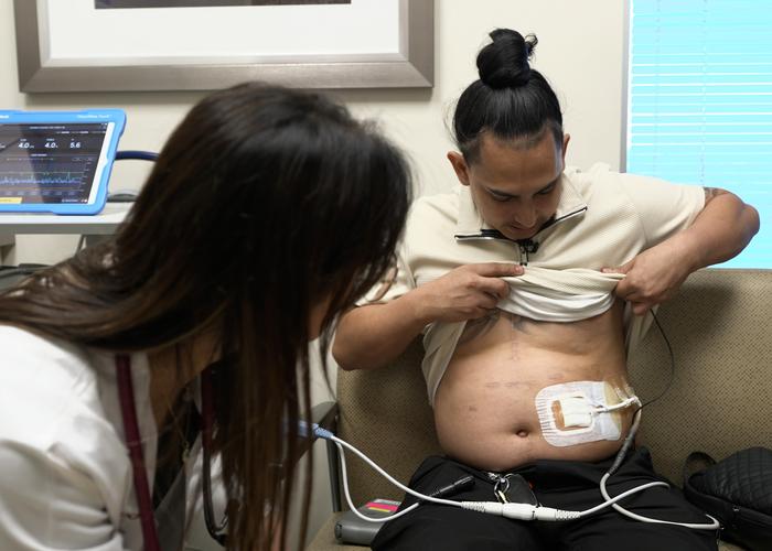 Heart failure patient Alex Balmes reveals LVAD