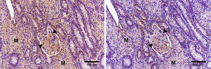 Immunohistochemical Analysis