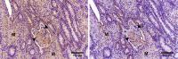 Immunohistochemical Analysis