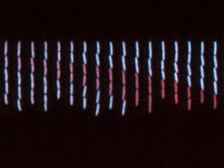 Microscopy Time-Lapse Pictures of E. Coli Cells
