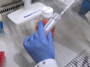 Billingham creating specialized media for microglia to grow in