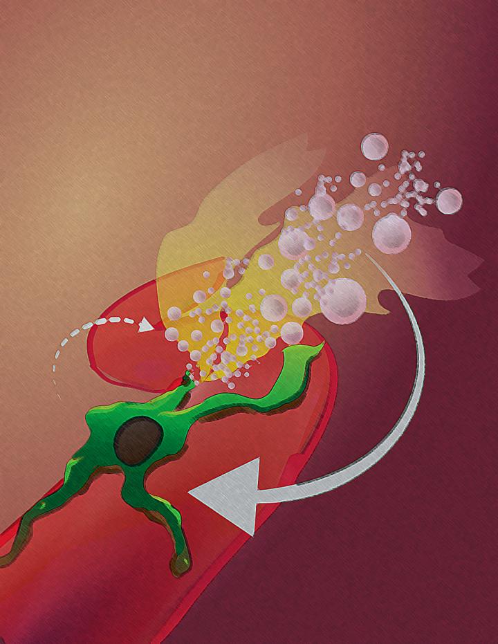 Cancer Treatments Combine Forces to Infiltrate Previously Unreachable Tumors (1 of 3)