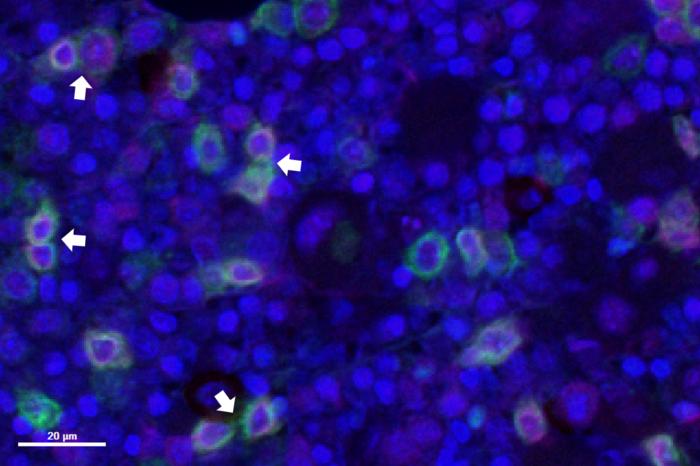 Mapping Human Bone Marrow Yields New Tool, Insights on Blood Cancer