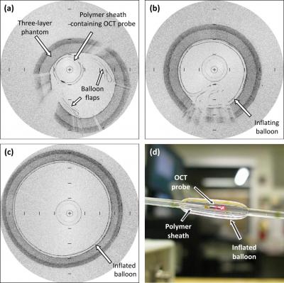 Three-Layer Phantom Mimics a Coronary Artery