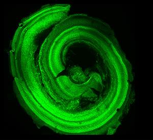 New Findings Hint toward Reversing Hearing Loss