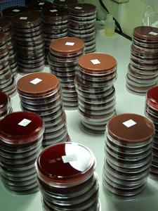 H. Influenza Cultures