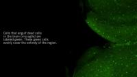 Brain Guardians Remove Dying Neurons