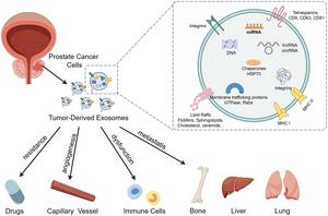 Role of tumor-derived exosomes in prostate cancer progression