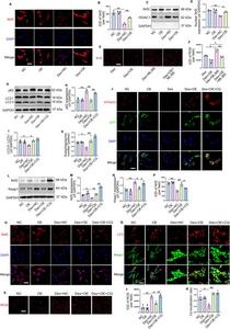 TIGAR activated nuclear factor erythroid-2 related factor (Nrf2) to reduce dexamethasone (Dex)-induced oxidative stress through inducing autophagy.