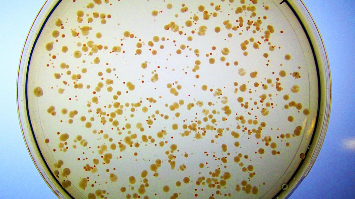 E. coli with Artificial Enzyme Syn-F4 Created by Princeton Researchers