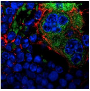Bone Marrow Nestin CD115