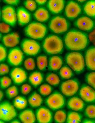Xenopus Frog Eggs