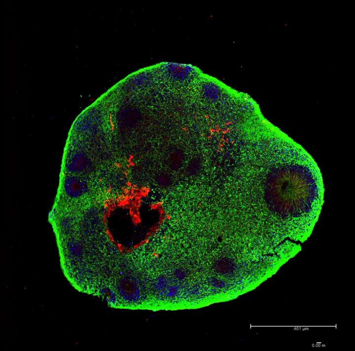 Brain Organoid