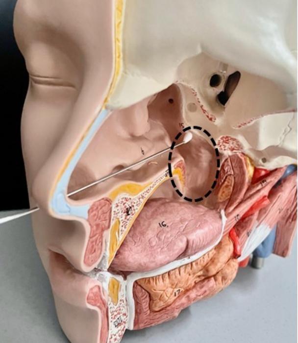 Anatomical location of the epipharynx