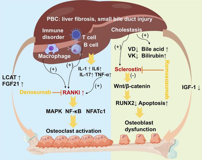 Primary Biliary Cholangitis–associated Osteoporosis