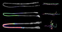 Collagen Strands