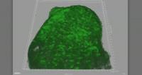 Shrinking Gel