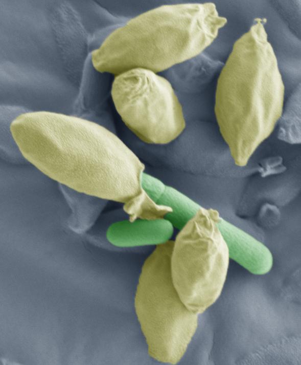 <i>Clostridium</i> Spore Germinating (2 of 2)