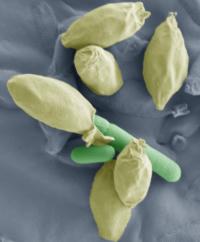 <i>Clostridium</i> Spore Germinating (2 of 2)