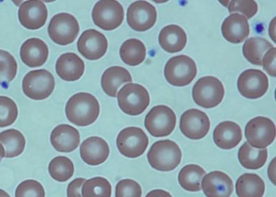 Blood Post-transplant
