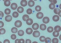 Blood Post-transplant