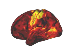 Brain on stimulant ADHD medication