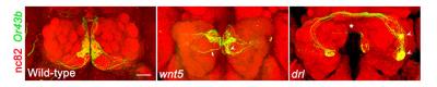 Antennal Lobe