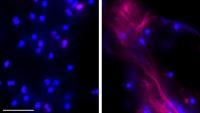 Neutrophils Extrude DNA Webs