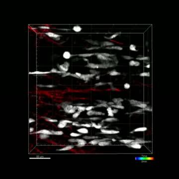 Muscle Stem Cells Follow 'Ghost Fibers' To Repair Site