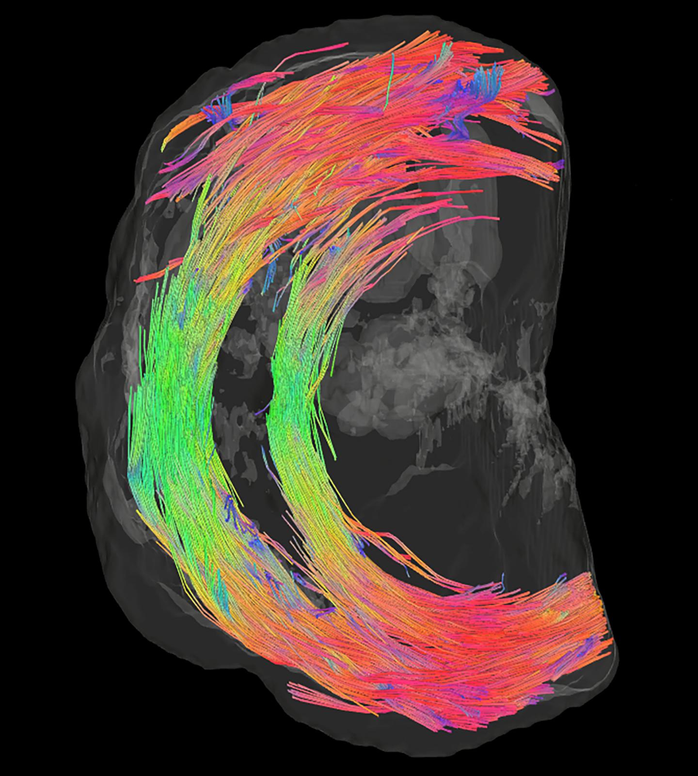 High Resolution Image of the Fibres Encircling the Cervis