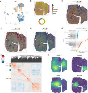 Spatial transcriptomics of PT-DLBCL tissue.