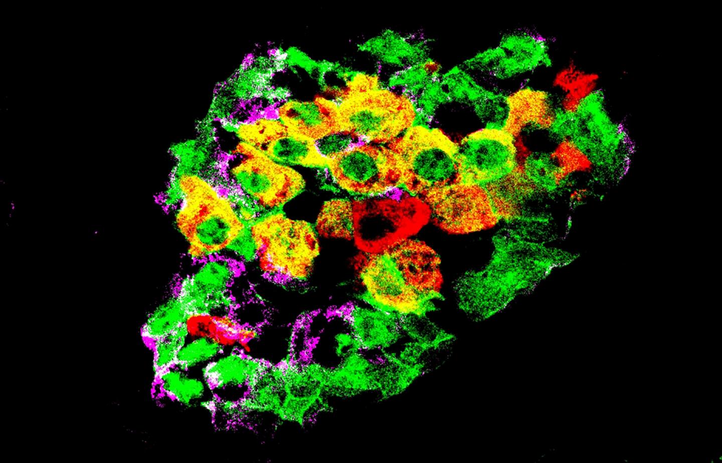 Mouse Pancreatic Islet