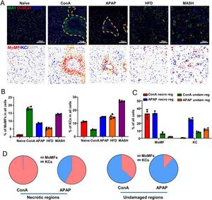 Quantification of KCs and MoMFs in healthy and diseased livers.