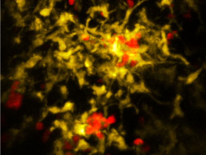 Once Killer Cells (Red) 2