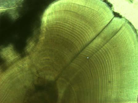 Flounder Otolith