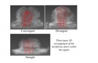 Three types 3D arrangement of the lactiferous ducts within the nipple