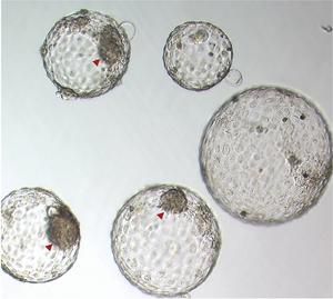 Human embryos cultured in vitro on day 8
