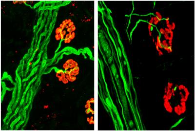 A Hydrogel Restores Breathing After Spinal Cord Injury in Animal Models