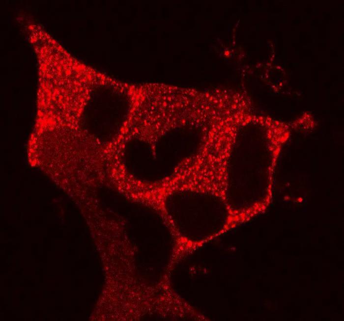 Light-activated β-arrestin 1 forms condensates in cells