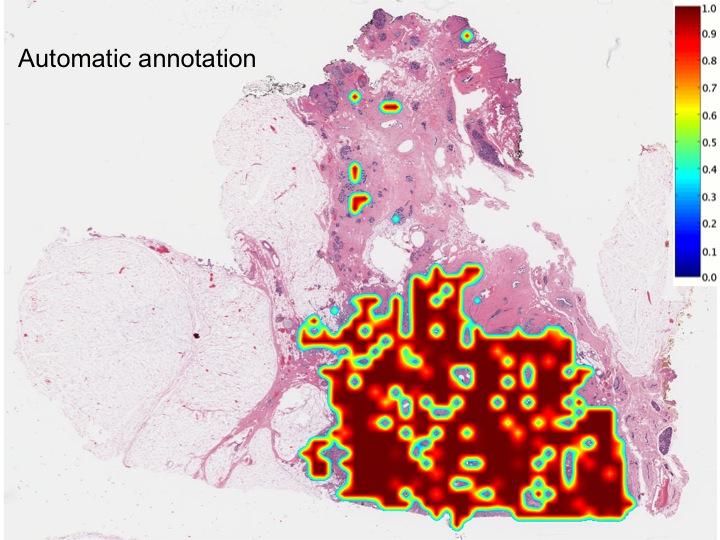Automated Annotation